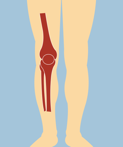 Projects Knee