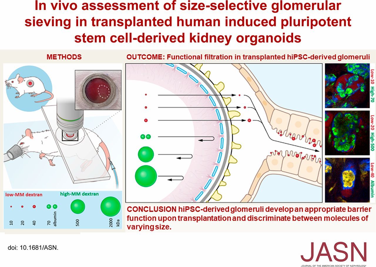 More advances in research on kidney organoids