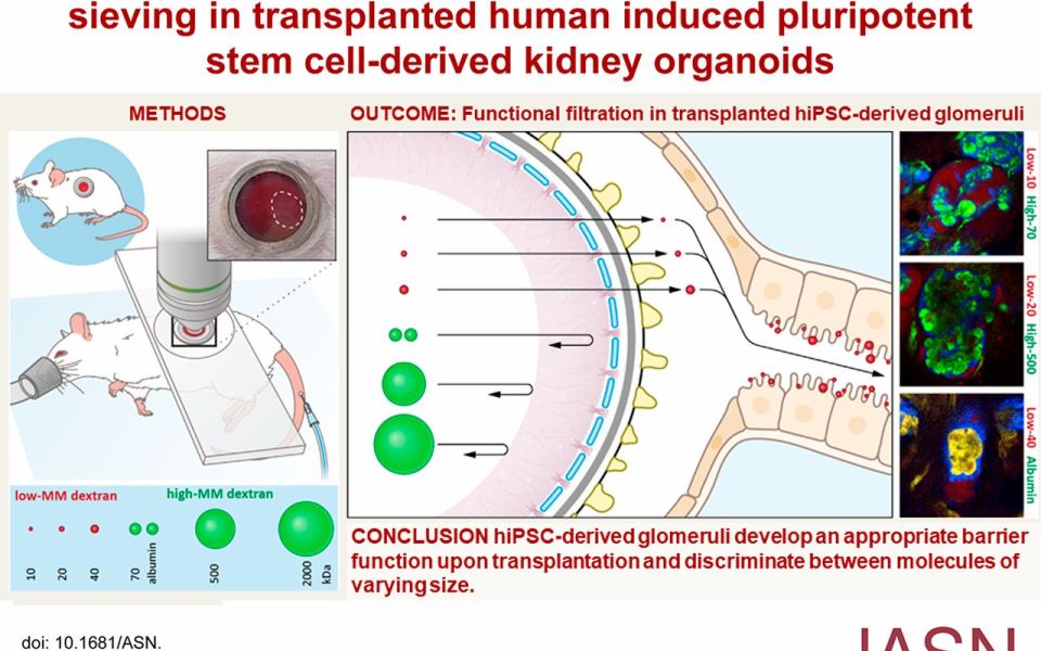 More advances in research on kidney organoids