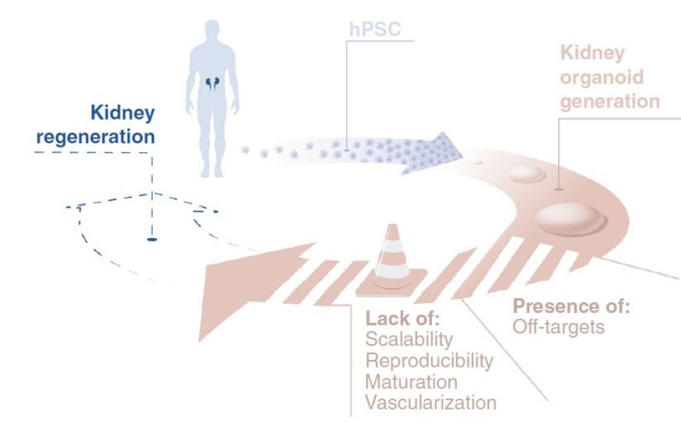 “Renal replacement therapy in Regenerative Medicine”