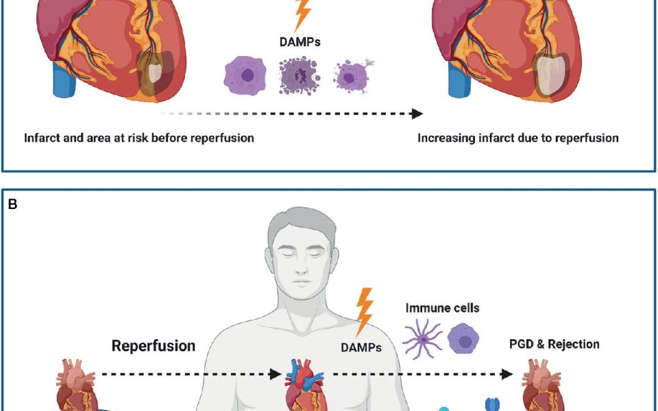 Damage-Associated Molecular Patterns in Myocardial Infarction and Heart Transplantation: The Road to Translational Success