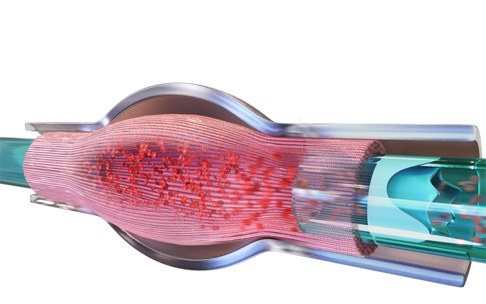 FIRST participates in 1.8 million seed investment for the discovery of two new drugs for heart failure